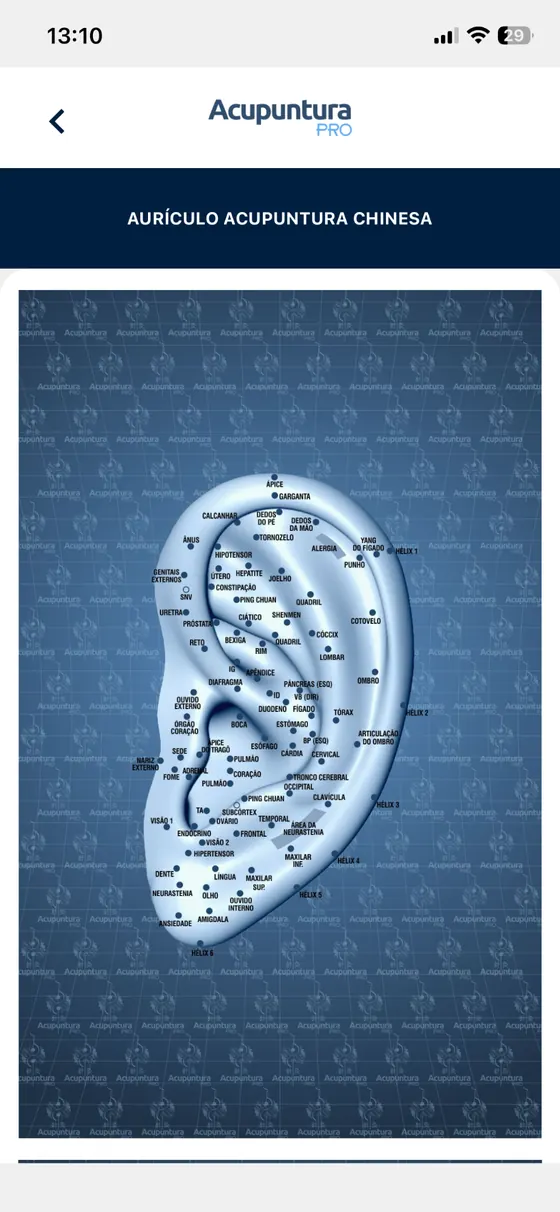 Exemplo de mapa de aurículo acupuntura no Acupuntura Pro